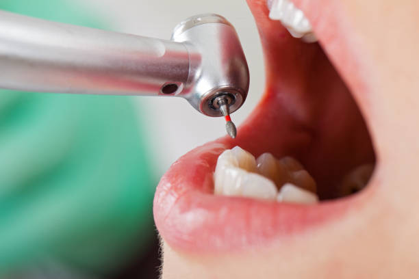 Best Pediatric Emergency Dentist in Clinton, NY